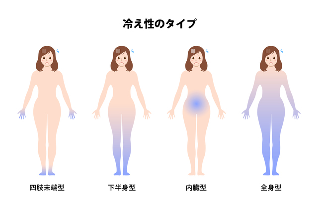 冷え性の４タイプのイラスト